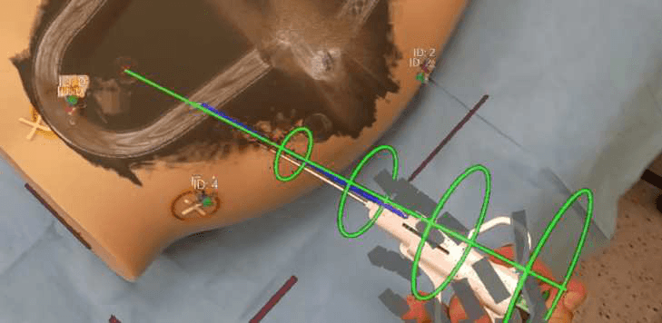 Navigation interface: trajectory rings and the tracked needle