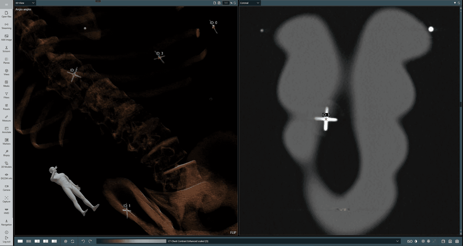 Indicating radiological markers in the imaging data